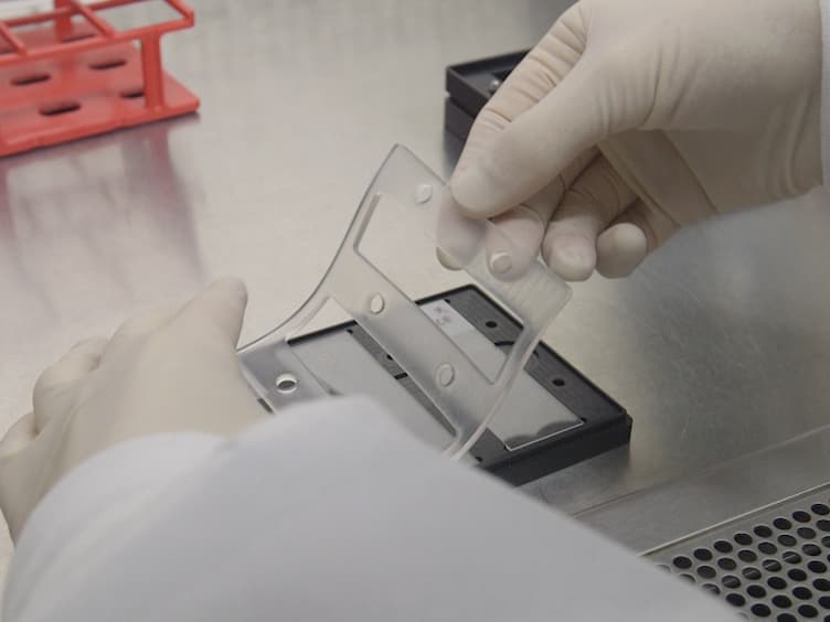 Zika Virus Specific Diagnostic Epitope Discovery