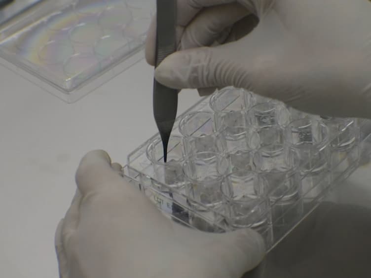 A Novel <em>In Vitro</em> Wound Healing Assay to Evaluate Cell Migration