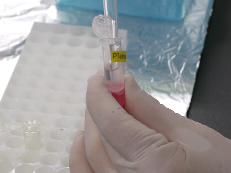 Absolute Quantification of Plasma MicroRNA Levels in Cynomolgus Monkeys, Using Quantitative Real-time Reverse Transcription PCR