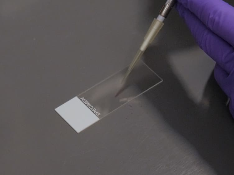 Automated Measurement of Cryptococcal Species Polysaccharide Capsule and Cell Body