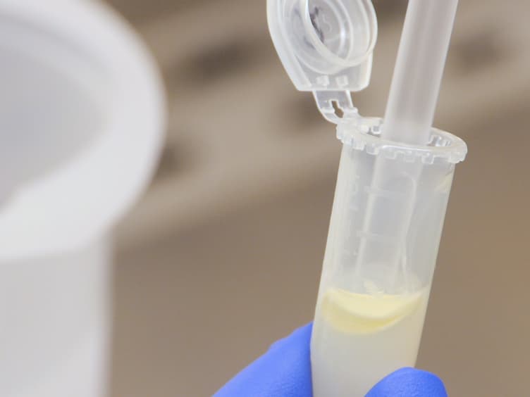 A Method for Targeted 16S Sequencing of Human Milk Samples