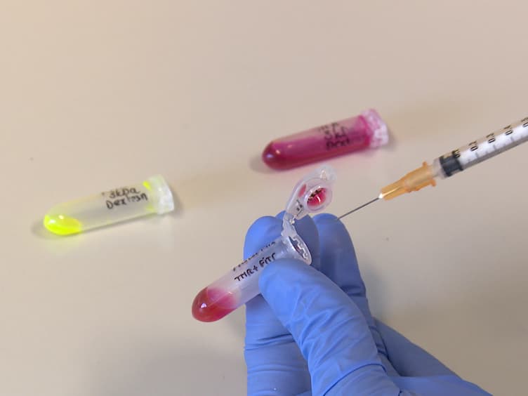 An <em>In Vivo</em> Blood-brain Barrier Permeability Assay in Mice Using Fluorescently Labeled Tracers