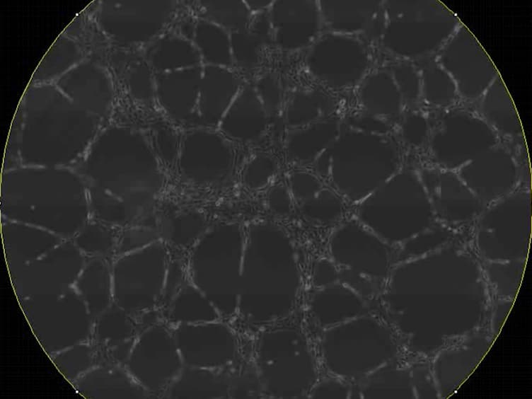 Kinetic Analysis of Vasculogenesis Quantifies Dynamics of Vasculogenesis and Angiogenesis <em>In Vitro</em>