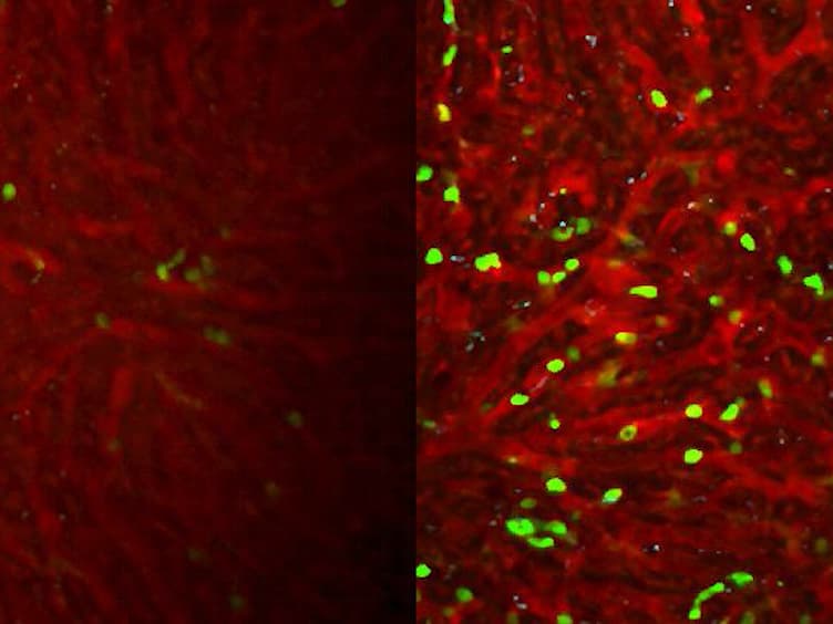Two-photon Intravital Imaging of Leukocytes During the Immune Response in Lipopolysaccharide-treated Mouse Liver