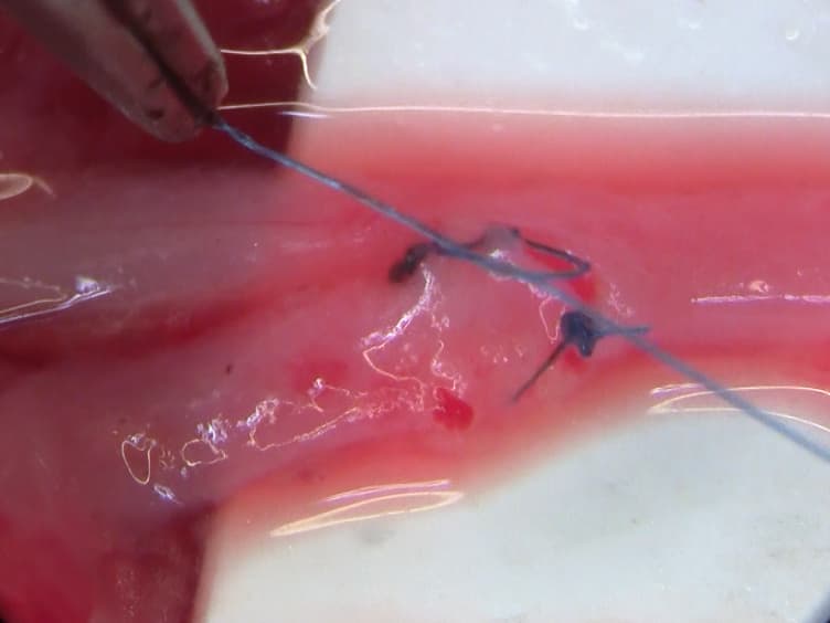 A Rabbit Model of Durable Transgene Expression in Jugular Vein to Common Carotid Artery Interposition Grafts
