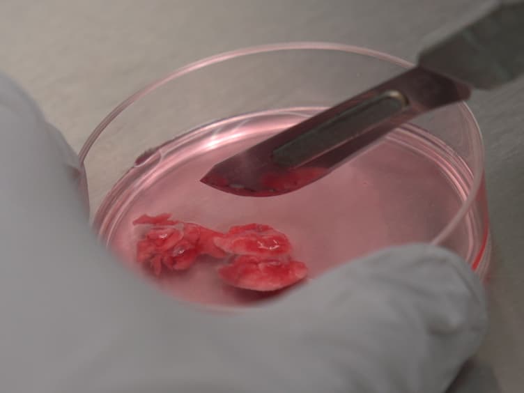 Isolation and <em>In Vitro</em> Culture of Murine and Human Alveolar Macrophages