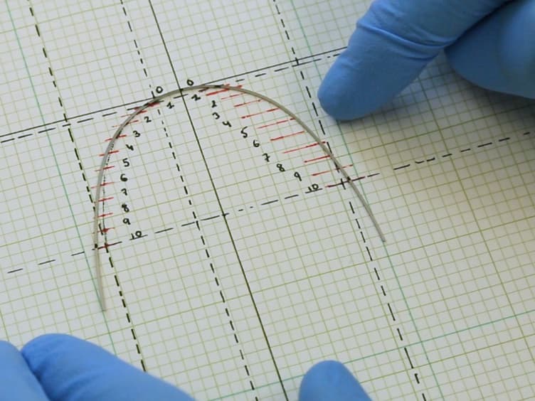 Force System with Vertical V-Bends: A 3D <em>In Vitro</em> Assessment of Elastic and Rigid Rectangular Archwires