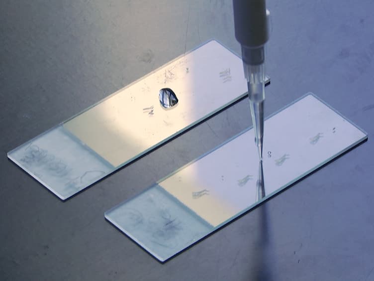 Using Terminal Transferase-mediated dUTP Nick End-labelling (TUNEL) and Caspase 3/7 Assays to Measure Epidermal Cell Death in Frogs with Chytridiomycosis