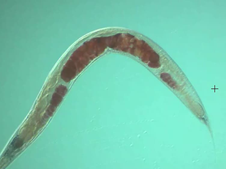 Quantification of Lipid Abundance and Evaluation of Lipid Distribution in <em>Caenorhabditis elegans</em> by Nile Red and Oil Red O Staining