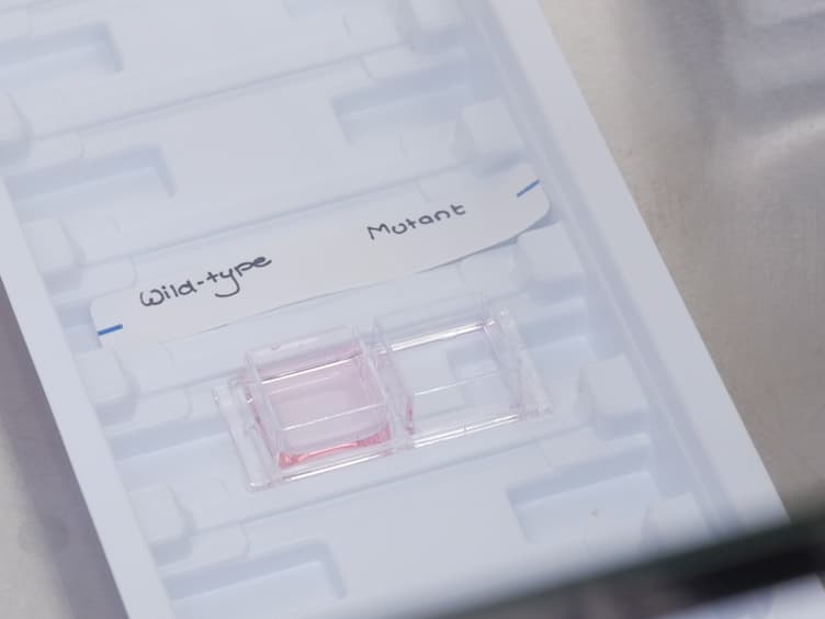 Live Cell Imaging of Chromosome Segregation During Mitosis
