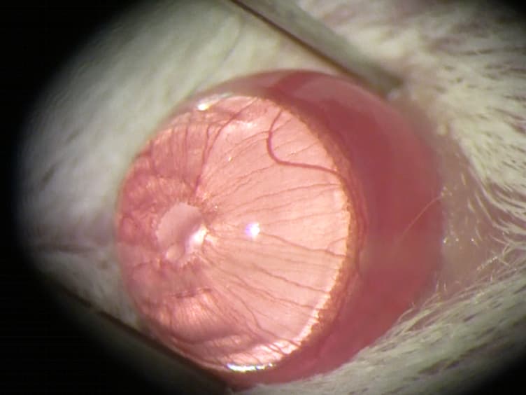 Puncture-Induced Iris Neovascularization as a Mouse Model of Rubeosis Iridis
