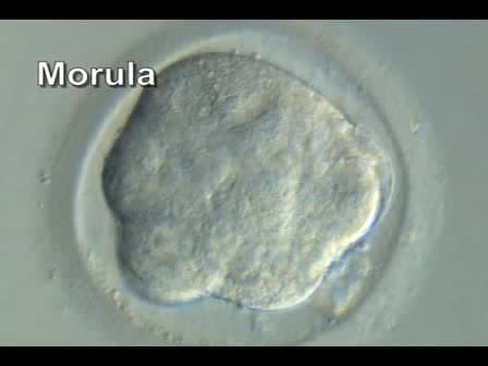 Derivation of Human Embryonic Stem Cells by Immunosurgery