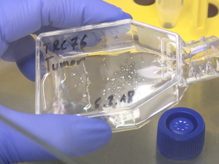 Isolation of Human Endothelial Cells from Normal Colon and Colorectal Carcinoma - An Improved Protocol