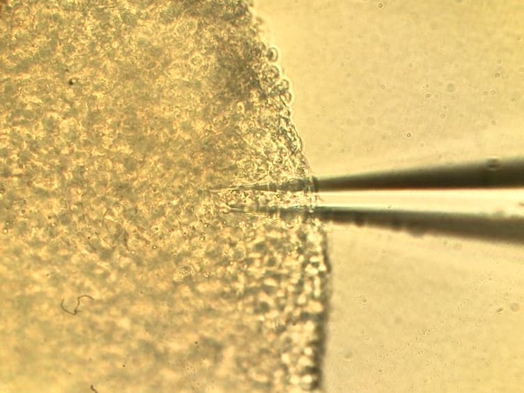 Preparations and Protocols for Whole Cell Patch Clamp Recording of Xenopus laevis Tectal Neurons