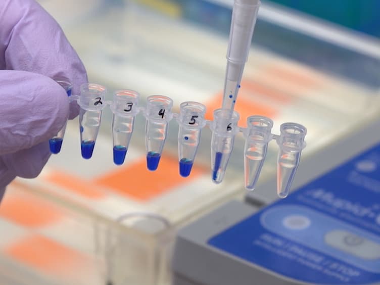 Evaluation of Exon Inclusion Induced by Splice Switching Antisense Oligonucleotides in SMA Patient Fibroblasts