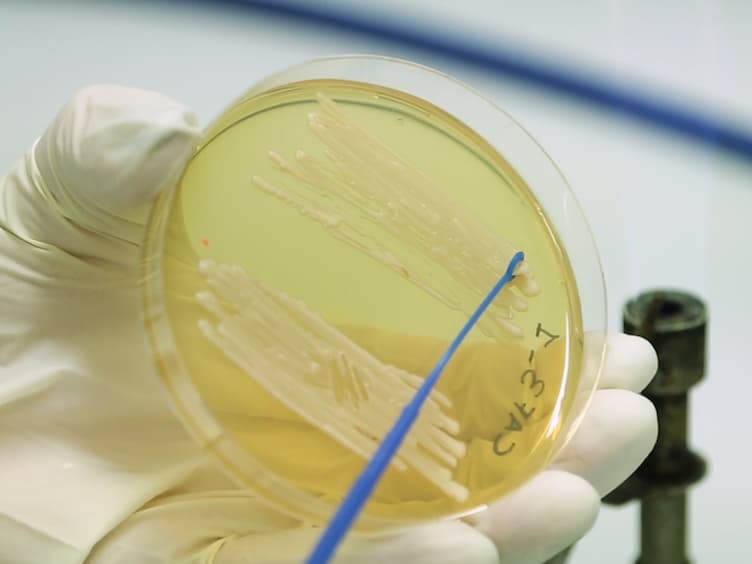 Deep Dermal Injection As a Model of Candida albicans Skin Infection for Histological Analyses