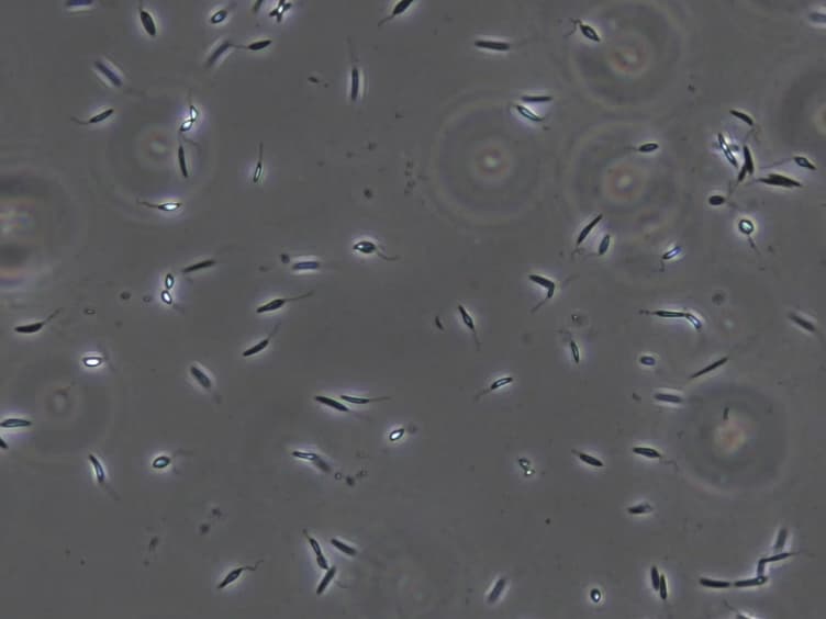 Polysome Profiling in <em>Leishmania</em>, Human Cells and Mouse Testis