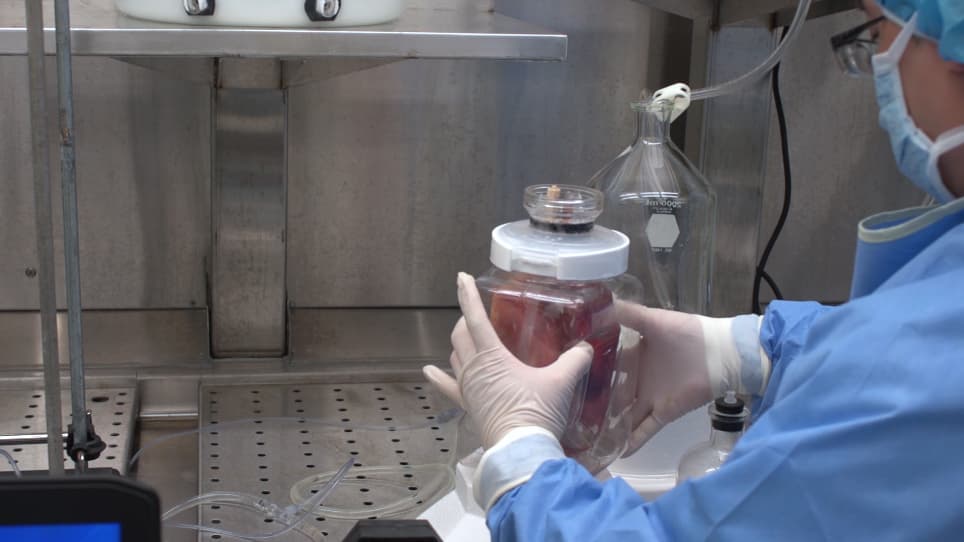 Decellularization of Whole Human Heart Inside a Pressurized Pouch in an Inverted Orientation