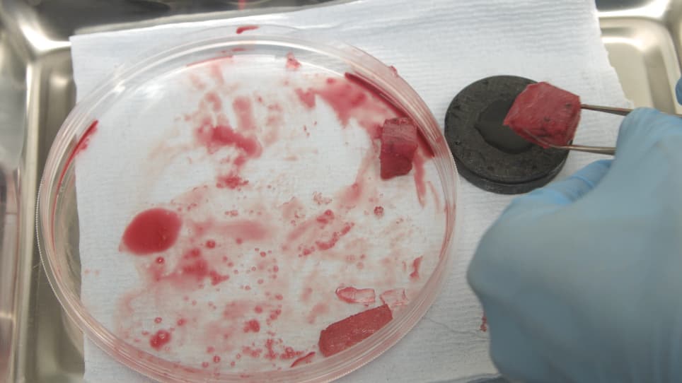 Generation of Human 3D Lung Tissue Cultures 3D-LTCs for Disease Modeling
