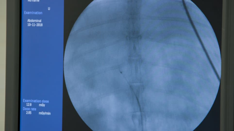 Development and Angiographic Use of the Rabbit VX2 Model for Liver Cancer