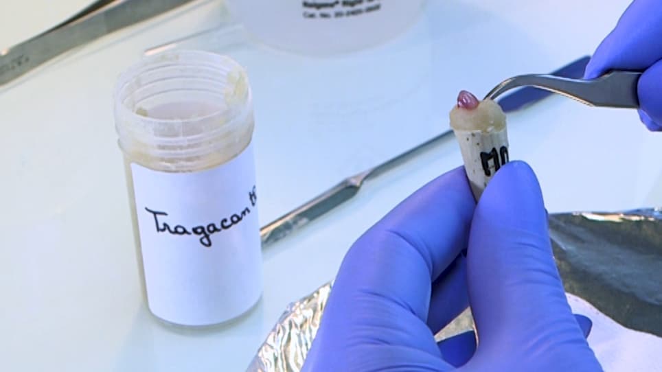 Immunolabelling Myofiber Degeneration in Muscle Biopsies