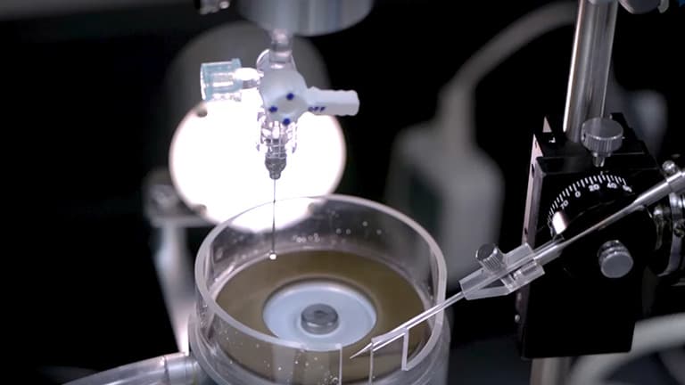 A Reversible Silicon Oil-Induced Ocular Hypertension Model in Mice
