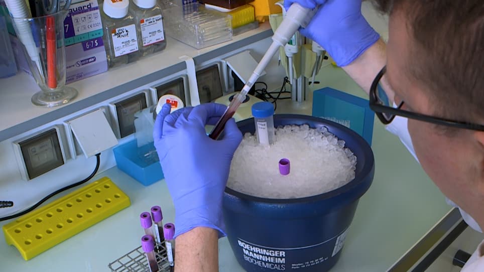 Measuring Erythrocyte Complement Receptor 1 Using Flow Cytometry
