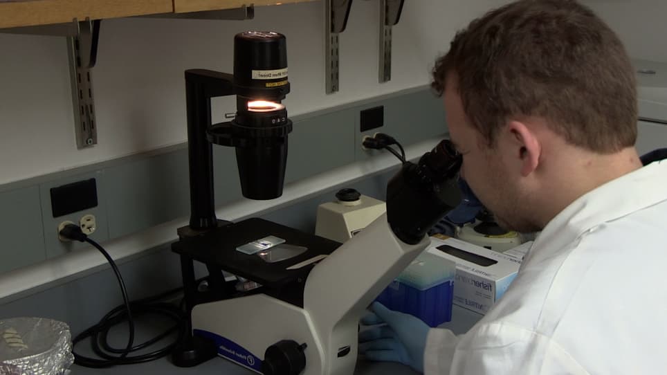 Isolation and Characterization of Adult Cardiac Fibroblasts and Myofibroblasts