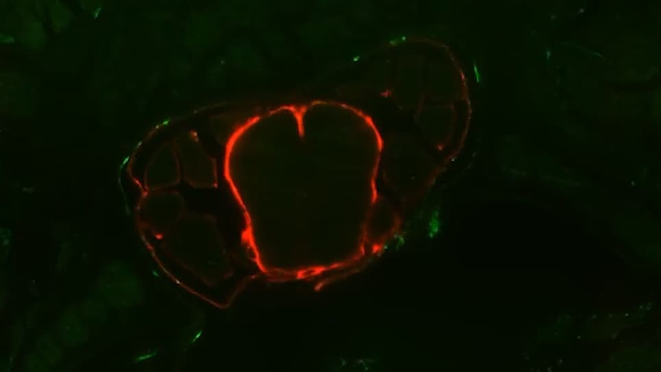 Three-Dimensional Imaging of the Vertebral Lymphatic Vasculature and Drainage using iDISCO<sup>+</sup> and Light Sheet Fluorescence Microscopy