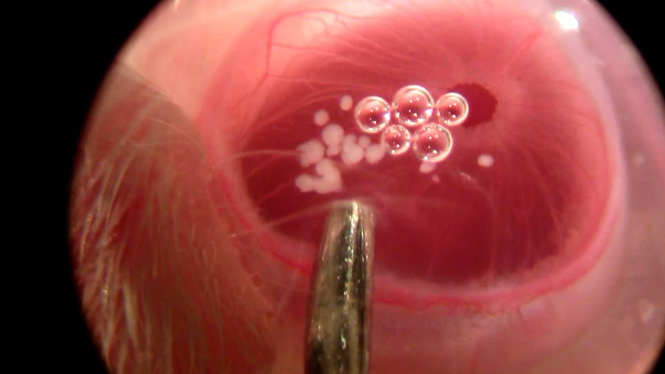 Longitudinal In Vivo Imaging and Quantification of Human Pancreatic Islet Grafting and Contributing Host Cells in the Anterior Eye Chamber