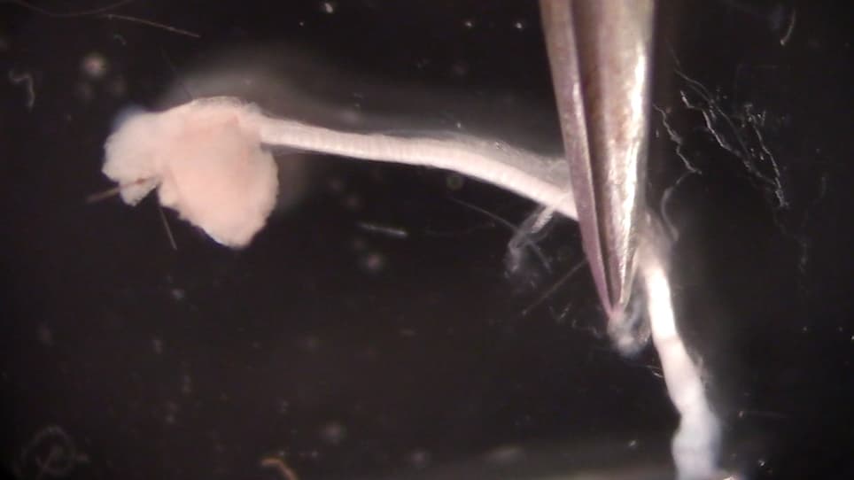 Imaging and Analysis of Neurofilament Transport in Excised Mouse Tibial Nerve