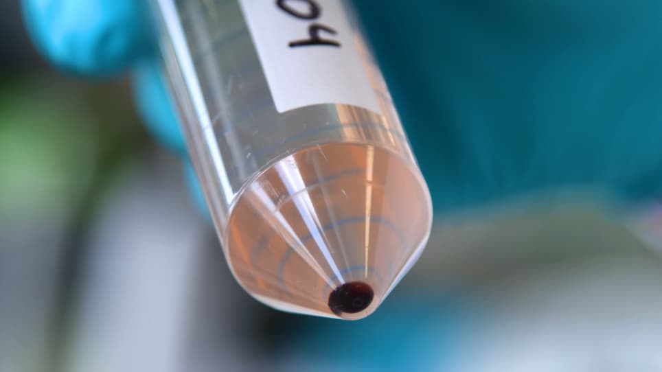 Measuring Naturally Acquired Phagocytosis-Inducing Antibodies to <em>Plasmodium falciparum</em> Parasites by a Flow Cytometry-Based Assay