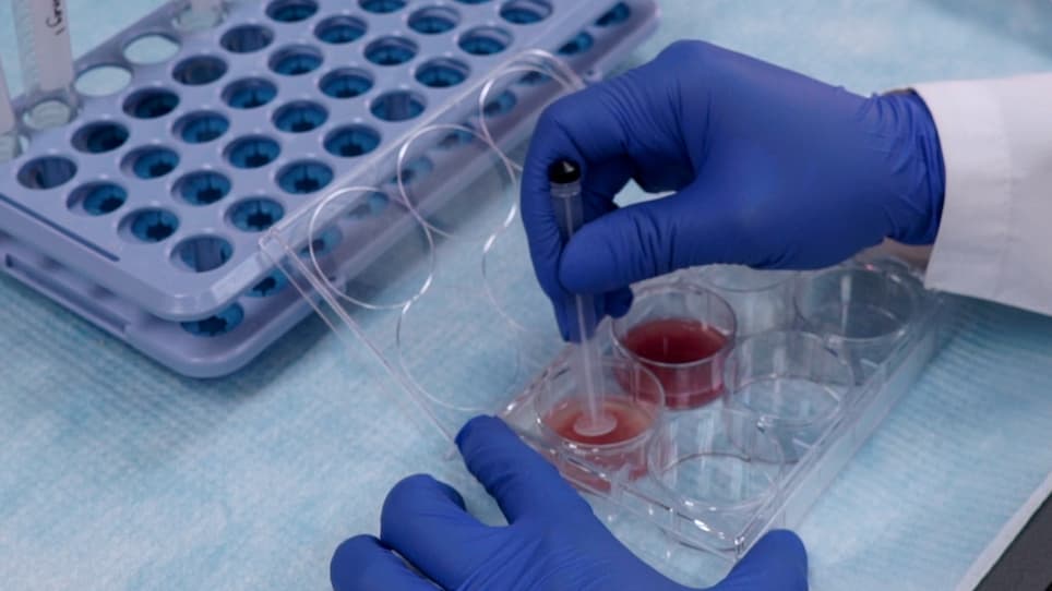 Isolation of Mouse Kidney-Resident CD8<sup>+</sup> T cells for Flow Cytometry Analysis