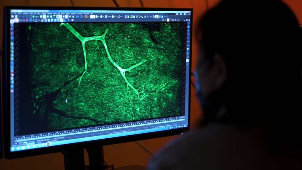 Dynamic Measurement and Imaging of Capillaries, Arterioles, and Pericytes in Mouse Heart