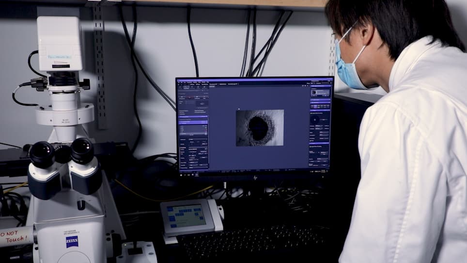 An Ex Vivo Choroid Sprouting Assay of Ocular Microvascular Angiogenesis