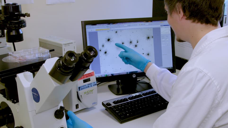 In Vitro Evaluation of Oncogenic Transformation in Human Mammary Epithelial Cells