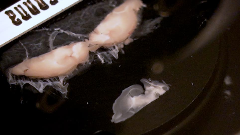 Horizontal Hippocampal Slices of the Mouse Brain