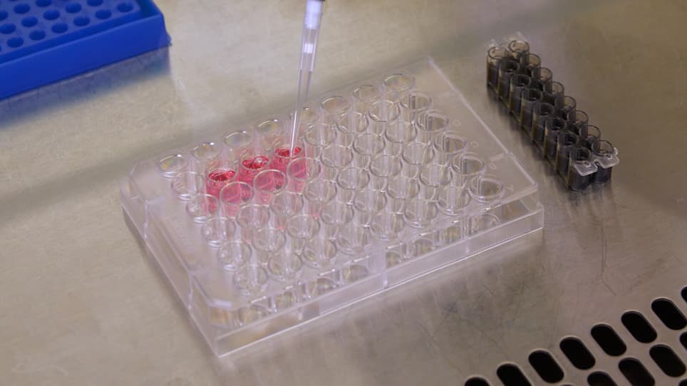 Genome Engineering of Primary Human B Cells Using CRISPR/Cas9