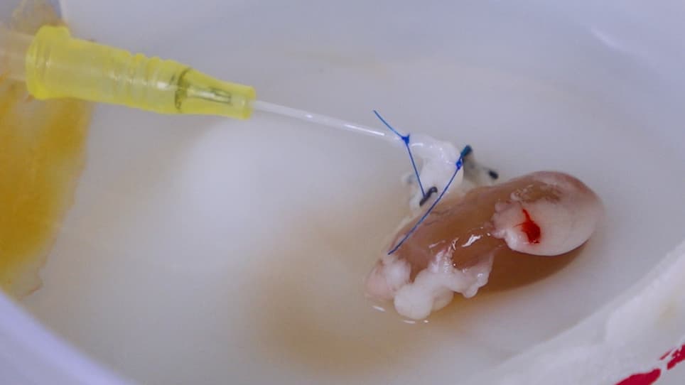 Preparation of Decellularized Kidney Scaffolds in Rats
