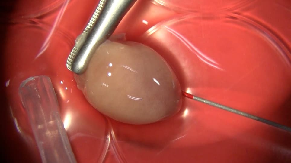 An Antegrade Perfusion Method for Cardiomyocyte Isolation from Mice