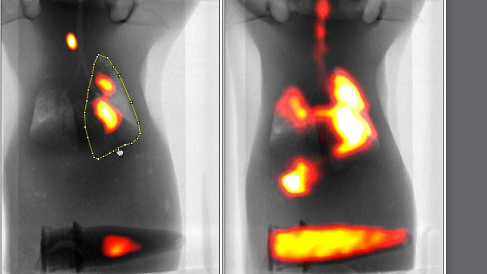 In vivo Evaluation of Mucociliary Clearance in Mice