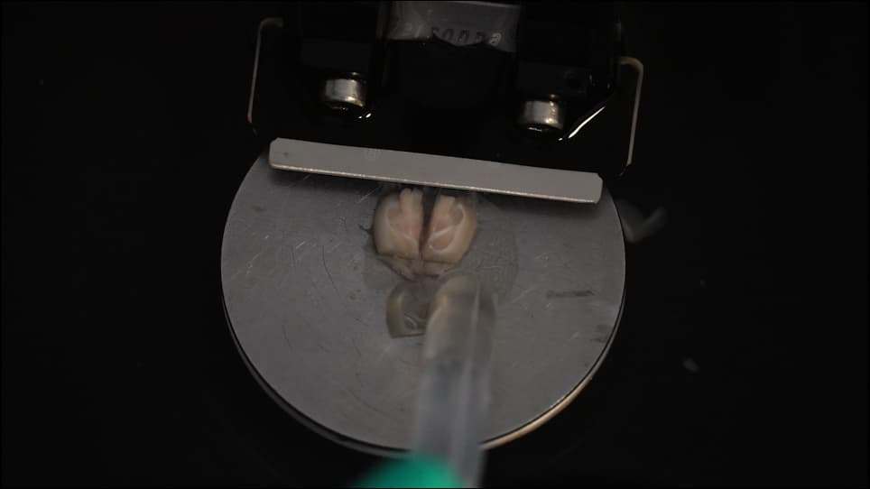 Preparation of Acute Slices from Dorsal Hippocampus for Whole-Cell Recording and Neuronal Reconstruction in the Dentate Gyrus of Adult Mice