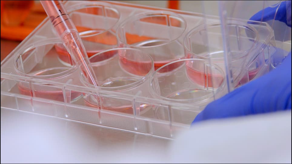 Isolation and Differentiation of Primary White and Brown Preadipocytes from Newborn Mice
