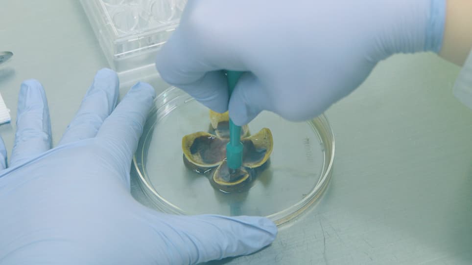 Characterization of a Novel Human Organotypic Retinal Culture Technique