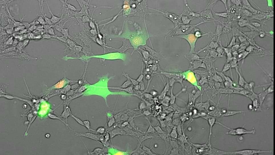 Co-culture of Glioblastoma Stem-like Cells on Patterned Neurons to Study Migration and Cellular Interactions