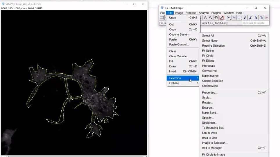 Automated Detection and Analysis of Exocytosis