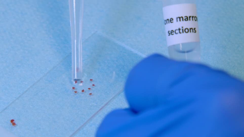 Proplatelet Formation Dynamics of Mouse Fresh Bone Marrow Explants