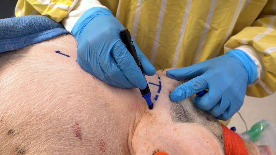 Direct Cannula Implantation in the Cisterna Magna of Pigs