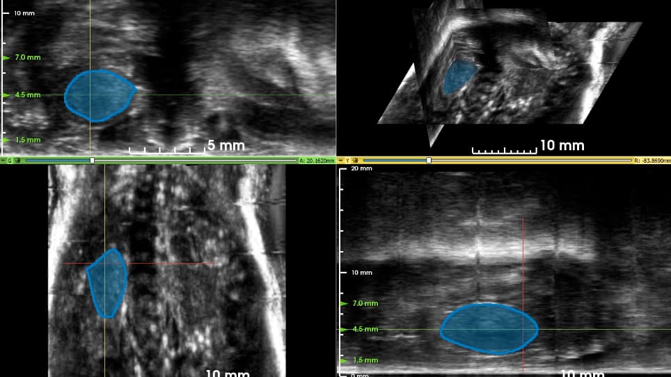 Use of 3D Robotic Ultrasound for In Vivo Analysis of Mouse Kidneys