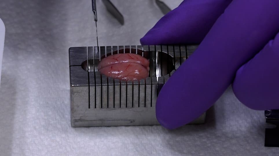 Rodent Heart and Brain Tissue Preparation for Digital Macro Photography after Ischemia-reperfusion